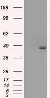 BCKDK Antibody (clone OTI11C9)