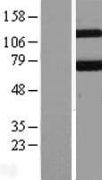 KEAP1 Protein (Over-Expression Lysate Myc-DDK (Flag))