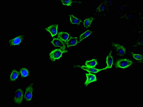 Polyclonal Rabbit anti-Human ATP1A1 Antibody (IHC, IF)