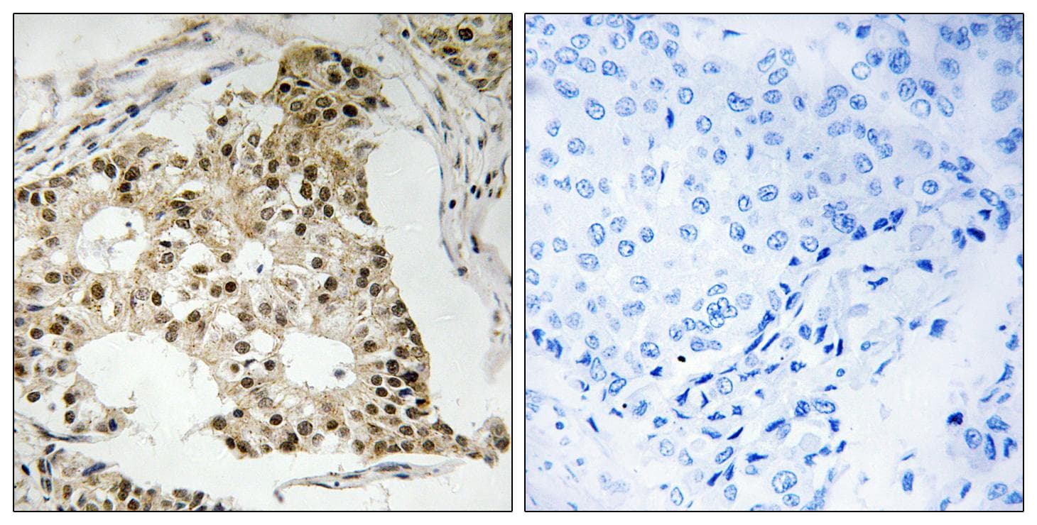 Polyclonal Rabbit anti-Human RARA / RAR Alpha Antibody (phospho-Ser77, IHC, WB)