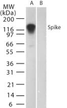 SARS-CoV Spike Glycoprotein Antibody (aa19-35)