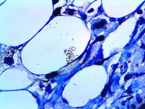 MTB / M. tuberculosis Antibody