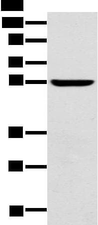 Polyclonal Rabbit anti-Human BF1 / FOXG1 Antibody (IHC, WB)