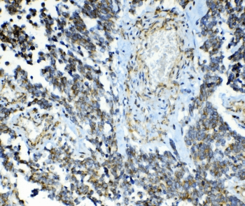 Polyclonal Rabbit anti-Human ABCC2 / MRP2 Antibody (IHC, WB)