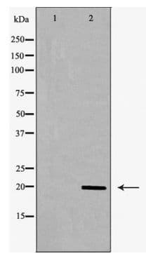 Polyclonal Rabbit anti-Human MRLC2 / MYL12B Antibody (IHC, WB)