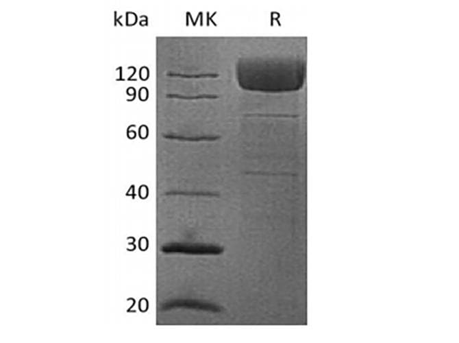 Human CD36 Protein (Recombinant Fc, C-terminus)