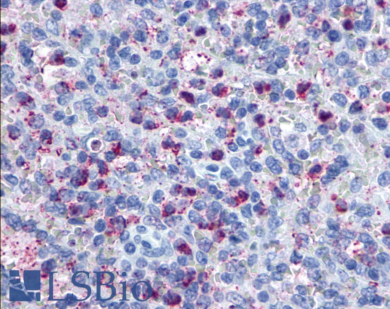 PathPlus™ GPR34 Antibody (C-Terminus)