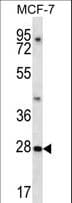 PDCL3 Antibody (aa39-68)