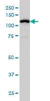 GABBR1 / GABA B Receptor 1 Antibody (clone 2D7)