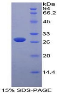 Mouse PKLR Protein (Recombinant His-T7)