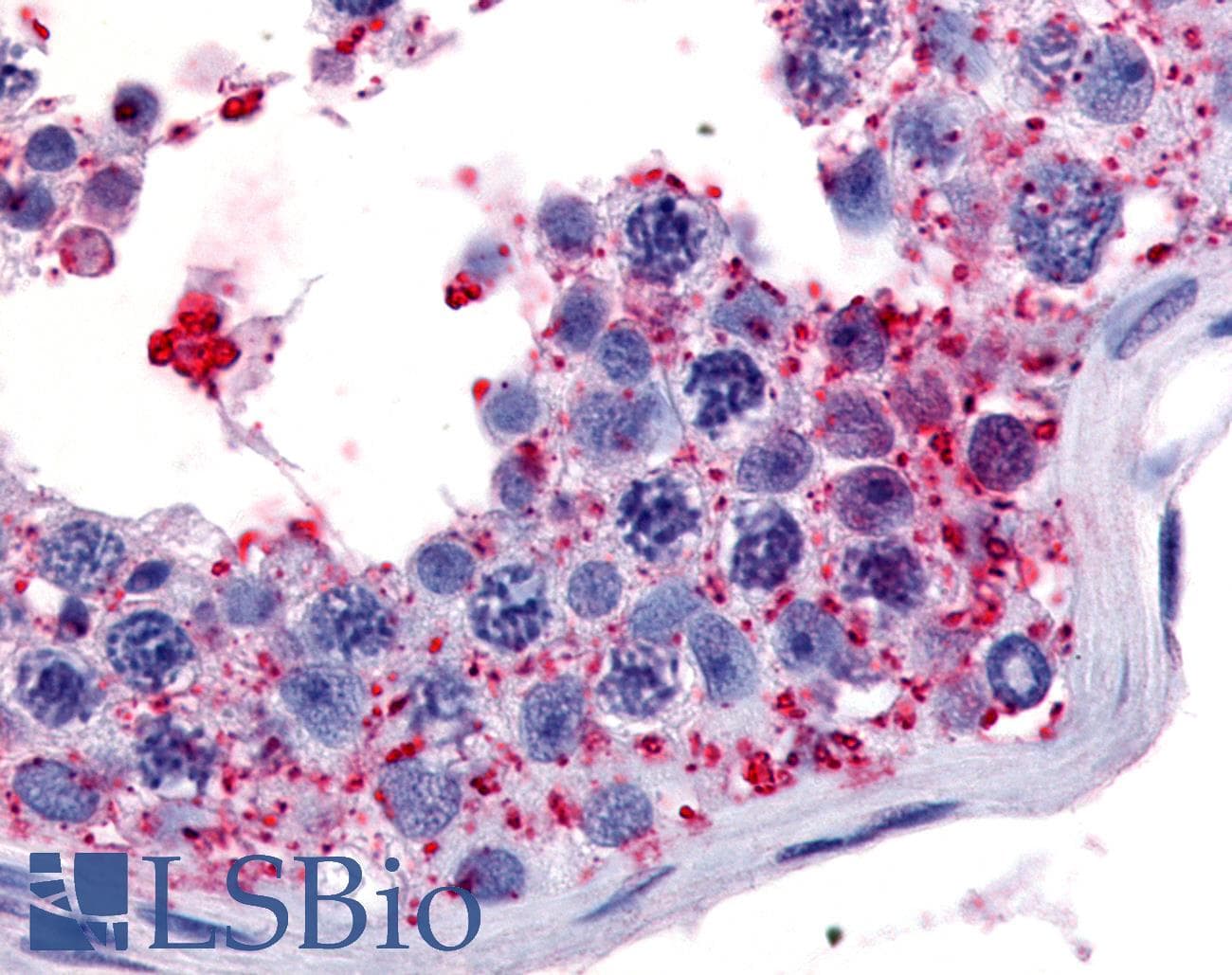 PathPlus™ Polyclonal Rabbit anti-Human WNK1 Antibody (Internal, IHC)