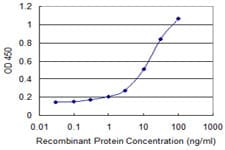 DECR1 Antibody (clone 3D4)