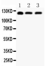 Polyclonal Rabbit anti-Human SIRT1 / Sirtuin 1 Antibody (aa112-311, WB)