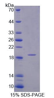 Human INPP4A Protein (Recombinant His-T7)