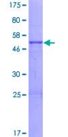Human ABHD14A Protein (Recombinant GST)