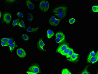Polyclonal Rabbit anti-Human TMEM91 Antibody