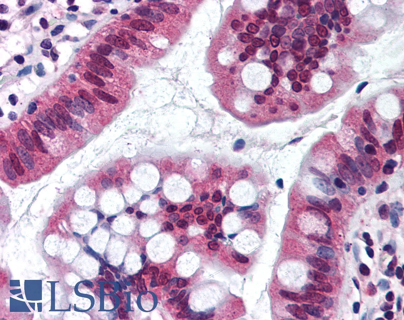 IHC-plus™ SRI / Sorcin Antibody (aa50-100)