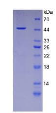 Human DSG3 / Desmoglein 3 Protein (Recombinant His-GST)