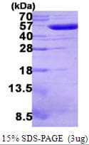 E. coli gor/Glutathione Oxidoreductase Protein (Recombinant His)