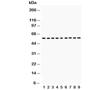 Vimentin Antibody (aa435-465)
