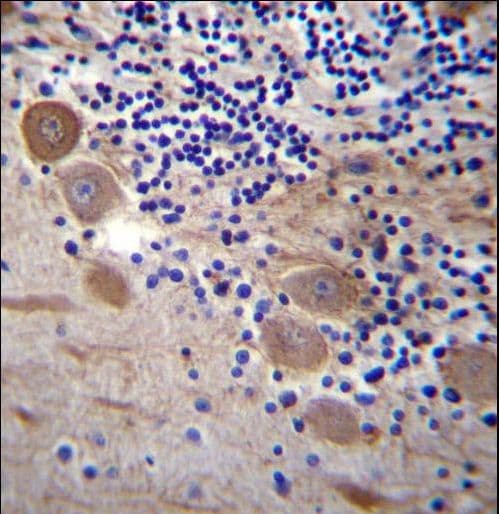 SSR2 Antibody (aa154-183)