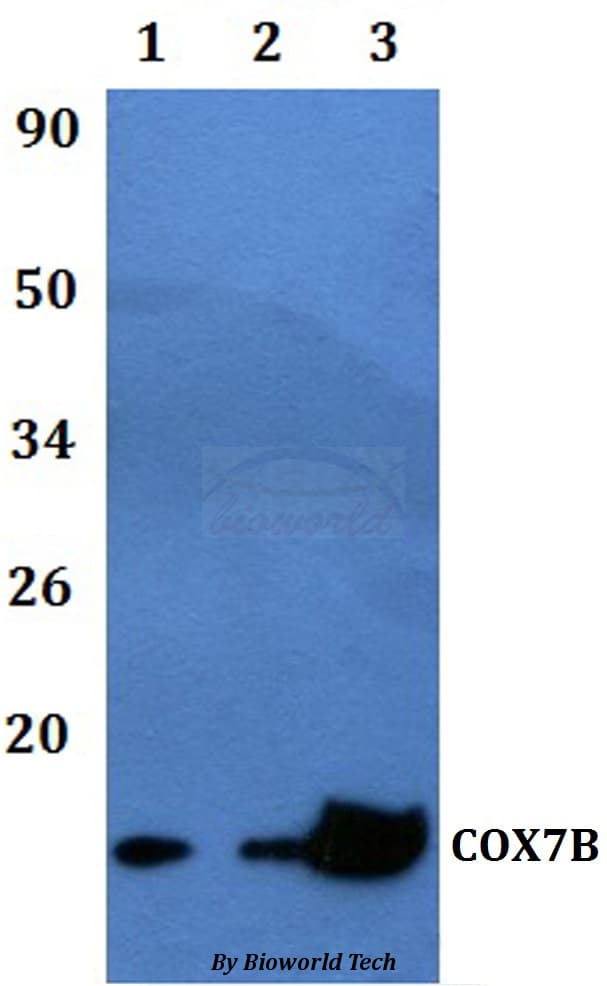 Polyclonal Rabbit anti-Human COX7B Antibody (WB)