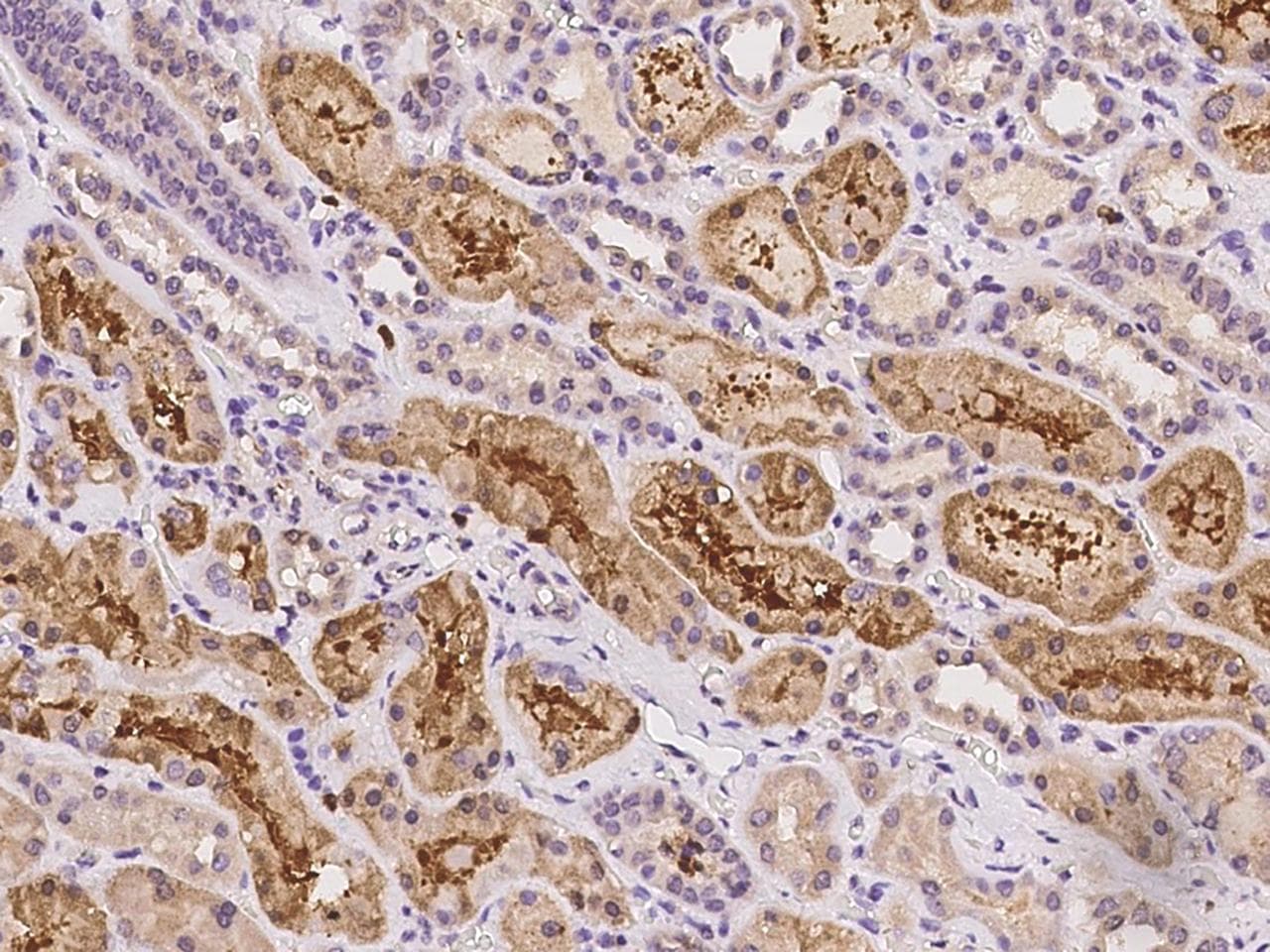 ZFHX2 / ZNF409 Antibody