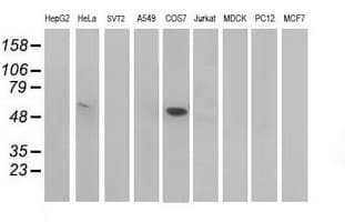 TP53 / p53 Antibody (clone OTI5D9)