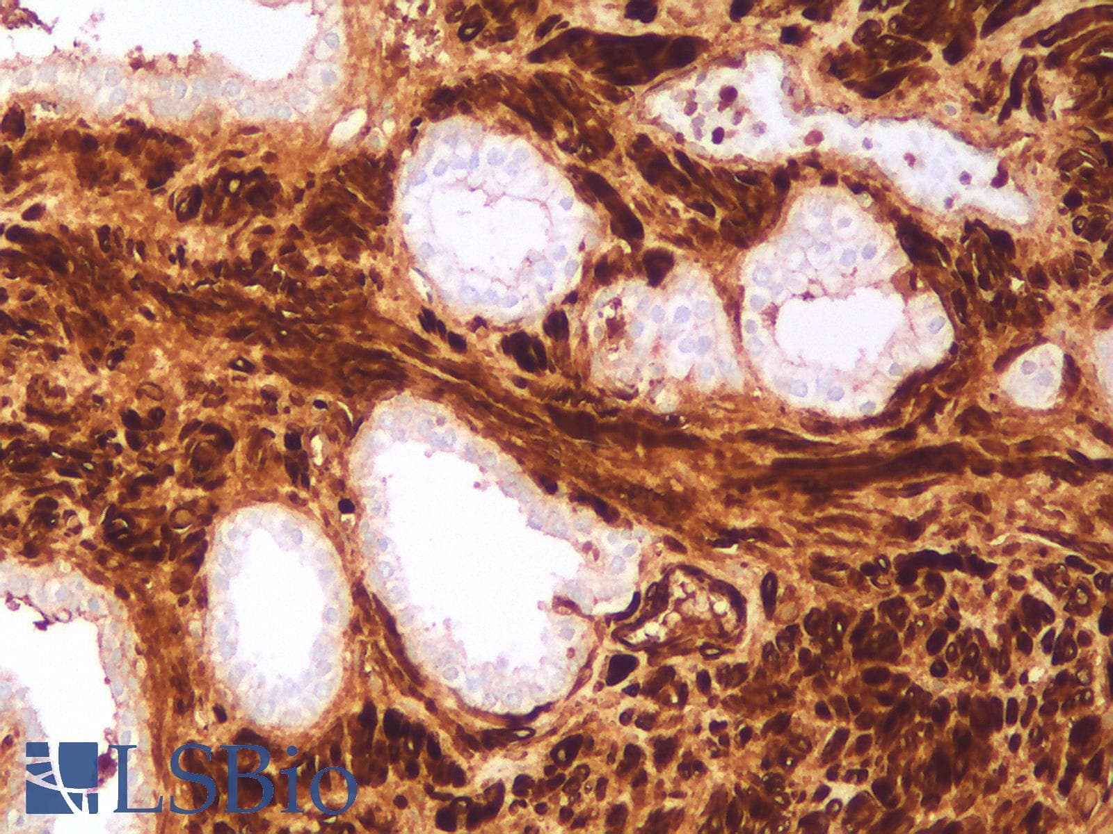 IHC-plus™ Recombinant Monoclonal Mouse anti-Human CALD1 / Caldesmon Antibody (clone rCALD1/820, IHC)