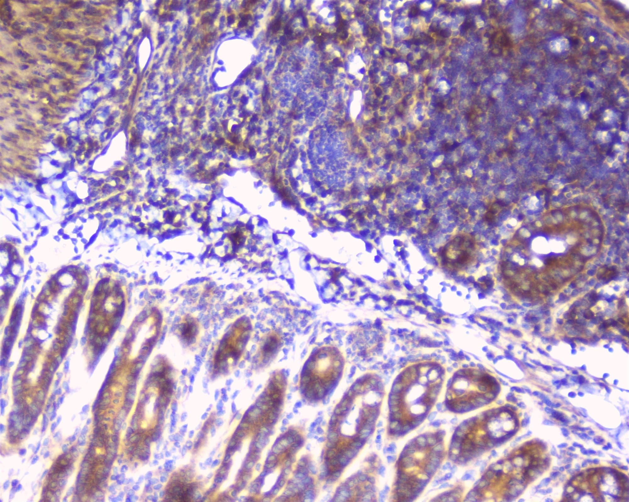 Polyclonal Rabbit anti-Human RPS3 / Ribosomal Protein S3 Antibody (IHC, WB)