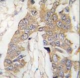 Polyclonal Rabbit anti-Mouse CASC3 / MLN51 Antibody (aa202-233, IHC, WB)