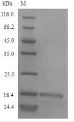 Calloselasma rhodostoma SLYA Protein (Recombinant 6His, N-terminus)