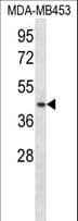 RING1 Antibody (aa95-123)