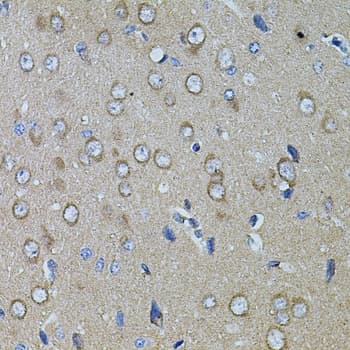 Polyclonal Rabbit anti-Human CHRFAM7A Antibody (IHC, WB)