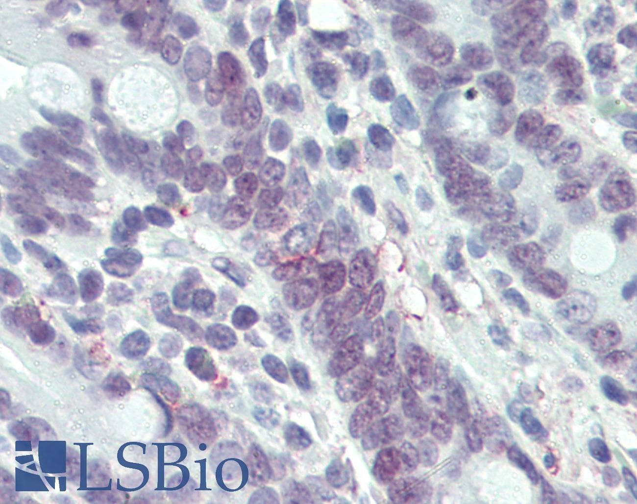 IHC-plus™ MLH1 Antibody (clone 4C9C7)