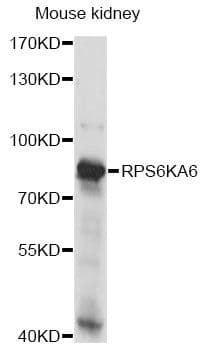 RPS6KA6 / RSK4 Antibody