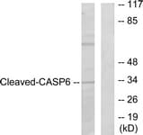 IHC-plus™ Polyclonal Rabbit anti-Human CASP6 / Caspase 6 Antibody (aa130-179, IHC, WB)