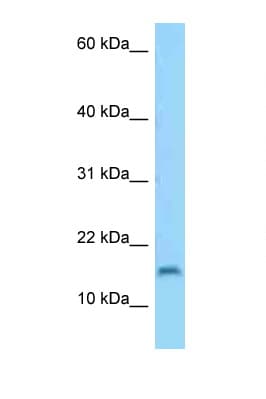 Polyclonal Rabbit anti-Human C3orf22 Antibody (aa50-99, WB)