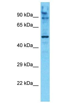 Polyclonal Rabbit anti-Human AMPD1 Antibody (aa181-230, WB)