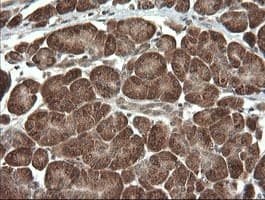 PIK3CG / PI3K Gamma Antibody (clone OTI1A9)