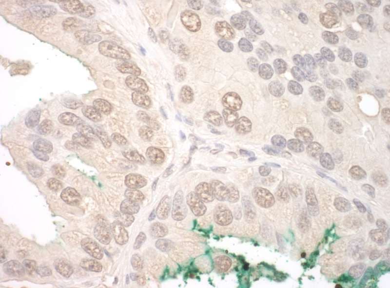 ORC2L / ORC2 Antibody (aa1-50)