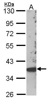 SKAP2 / SCAP2 Antibody (aa296-359)