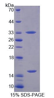 Human PGM3 Protein (Recombinant His, N-Terminal)