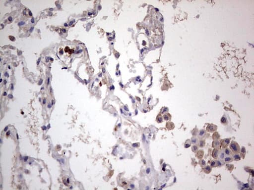Monoclonal Mouse anti-Human PKM2 Antibody (clone 1F12, IHC, WB)