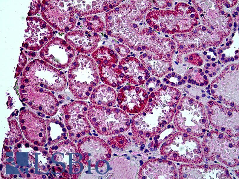 IHC-plus™ Polyclonal Goat anti-Human HYAL2 Antibody (aa2-12, IHC)