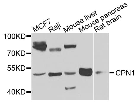 CPN1 Antibody