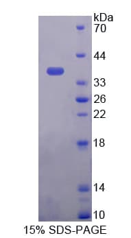 Rat DUOX2 Protein (Recombinant His-T7)