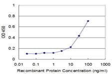 CNOT2 Antibody (clone 2E10)
