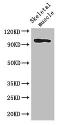 SLFN11 Antibody