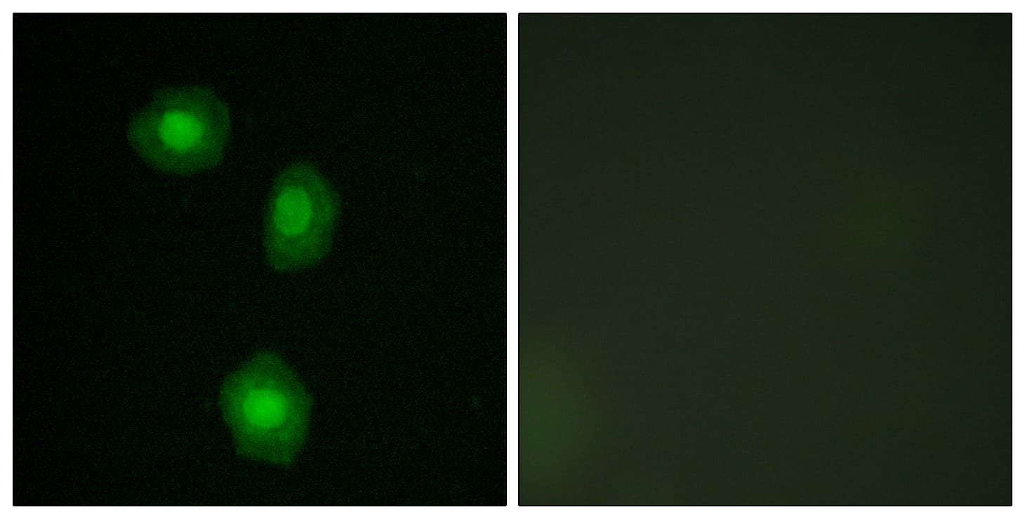 Polyclonal Rabbit anti-Human RPS6KA5 / MSK1 Antibody (aa343-392, IF, WB)
